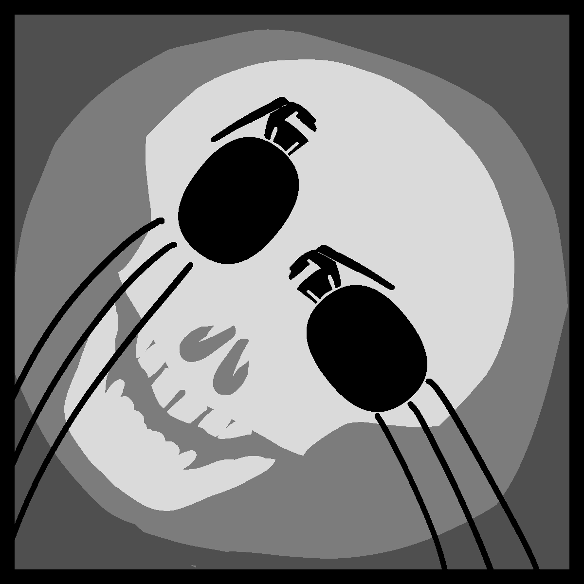 Mutually-Assured Destruction